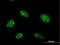 Zinc Finger Protein 593 antibody, H00051042-B02P, Novus Biologicals, Immunocytochemistry image 