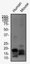 Lysyl Oxidase antibody, NB110-41568, Novus Biologicals, Western Blot image 