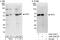 SUFU Negative Regulator Of Hedgehog Signaling antibody, A302-335A, Bethyl Labs, Immunoprecipitation image 