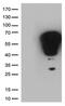 Fos Proto-Oncogene, AP-1 Transcription Factor Subunit antibody, NBP2-45694, Novus Biologicals, Western Blot image 