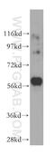 PK1 antibody, 17580-1-AP, Proteintech Group, Western Blot image 