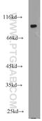 DAB Adaptor Protein 2 antibody, 10109-2-AP, Proteintech Group, Western Blot image 