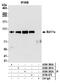 BAF Chromatin Remodeling Complex Subunit BCL11A antibody, A300-380A, Bethyl Labs, Immunoprecipitation image 