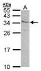KIR antibody, TA308309, Origene, Western Blot image 