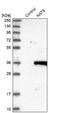 N-acetyltransferase 9 antibody, NBP1-85088, Novus Biologicals, Western Blot image 