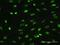 Melanoma-associated antigen 2 antibody, MA5-24545, Invitrogen Antibodies, Immunofluorescence image 
