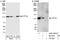 Chromosome transmission fidelity protein 18 homolog antibody, A301-883A, Bethyl Labs, Immunoprecipitation image 