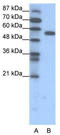 Forkhead box protein C2 antibody, TA329393, Origene, Western Blot image 