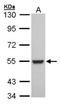 Retinoid X Receptor Beta antibody, orb73827, Biorbyt, Western Blot image 