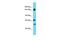 Ankyrin Repeat Domain 18B antibody, PA5-46405, Invitrogen Antibodies, Western Blot image 