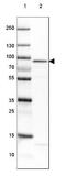 Adenosine Monophosphate Deaminase 1 antibody, NBP1-81269, Novus Biologicals, Western Blot image 