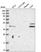 Rh Family B Glycoprotein (Gene/Pseudogene) antibody, HPA042726, Atlas Antibodies, Western Blot image 
