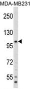 Complement C6 antibody, AP17160PU-N, Origene, Western Blot image 