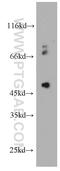 Phosphatidylinositol Glycan Anchor Biosynthesis Class M antibody, 20421-1-AP, Proteintech Group, Western Blot image 