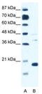 Calcium Voltage-Gated Channel Auxiliary Subunit Gamma 1 antibody, TA331452, Origene, Western Blot image 
