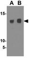 Secretory Leukocyte Peptidase Inhibitor antibody, GTX85436, GeneTex, Western Blot image 