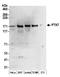 Protein Tyrosine Kinase 7 (Inactive) antibody, A304-451A, Bethyl Labs, Western Blot image 