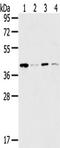 MAGE Family Member A11 antibody, TA351370, Origene, Western Blot image 