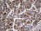 Glucosylceramidase Beta antibody, LS-C798045, Lifespan Biosciences, Immunohistochemistry paraffin image 