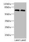 Patatin Like Phospholipase Domain Containing 1 antibody, orb35629, Biorbyt, Western Blot image 