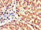 Kelch Repeat And BTB Domain Containing 6 antibody, CSB-PA774812LA01HU, Cusabio, Immunohistochemistry frozen image 