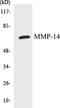 Matrix Metallopeptidase 14 antibody, EKC1376, Boster Biological Technology, Western Blot image 