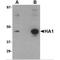 Influenza A Virus Hemagglutinin  antibody, NBP1-75493, Novus Biologicals, Western Blot image 