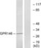 Probable G-protein coupled receptor 146 antibody, LS-C120690, Lifespan Biosciences, Western Blot image 