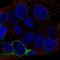 Ceroid-lipofuscinosis neuronal protein 6 antibody, HPA074162, Atlas Antibodies, Immunofluorescence image 