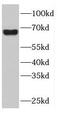 DnaJ Heat Shock Protein Family (Hsp40) Member C11 antibody, FNab02458, FineTest, Western Blot image 