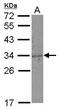 CD159a antibody, GTX108497, GeneTex, Western Blot image 