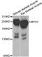 MyHC-slow antibody, orb373640, Biorbyt, Western Blot image 