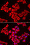 Small muscular protein antibody, STJ28827, St John