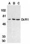 TNF Receptor Superfamily Member 10c antibody, TA306046, Origene, Western Blot image 