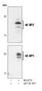 Eukaryotic Translation Initiation Factor 4E Binding Protein 2 antibody, PA5-17527, Invitrogen Antibodies, Western Blot image 