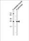 Chymotrypsin Like Elastase 2B antibody, PA5-49494, Invitrogen Antibodies, Western Blot image 