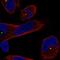 Centrosomal Protein 250 antibody, HPA064875, Atlas Antibodies, Immunofluorescence image 
