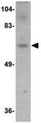 Dishevelled Binding Antagonist Of Beta Catenin 3 antibody, GTX85372, GeneTex, Western Blot image 