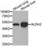 Aldehyde dehydrogenase, mitochondrial antibody, LS-C331368, Lifespan Biosciences, Western Blot image 
