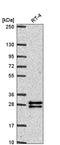 F-Box Protein 36 antibody, HPA053865, Atlas Antibodies, Western Blot image 