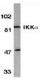 Inhibitor of nuclear factor kappa-B kinase subunit alpha antibody, ADI-KAP-TF116-E, Enzo Life Sciences, Western Blot image 