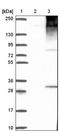ELOVL Fatty Acid Elongase 3 antibody, NBP1-85618, Novus Biologicals, Western Blot image 