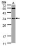 Methylthioadenosine Phosphorylase antibody, LS-C186047, Lifespan Biosciences, Western Blot image 
