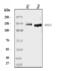 Desmoglein 3 antibody, A03093, Boster Biological Technology, Western Blot image 