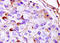 Fibroblast Growth Factor Receptor 1 antibody, 250651, Abbiotec, Immunohistochemistry paraffin image 