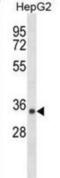 Short Chain Dehydrogenase/Reductase Family 39U Member 1 antibody, abx030187, Abbexa, Western Blot image 