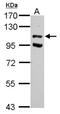Ubiquitin carboxyl-terminal hydrolase 37 antibody, NBP2-20833, Novus Biologicals, Western Blot image 