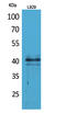 C-C Motif Chemokine Receptor 4 antibody, A00755-3, Boster Biological Technology, Western Blot image 