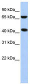 ElaC Ribonuclease Z 1 antibody, TA346015, Origene, Western Blot image 