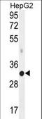 hMed6 antibody, LS-C164124, Lifespan Biosciences, Western Blot image 